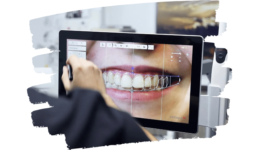 AR Smile Application