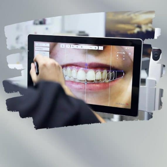 AR Smile Application - miniature
